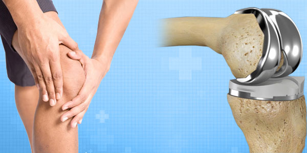 Knee joint replacement in Bhopal